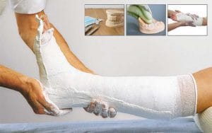 گچ پزشکی و گچ دندان پزشکی