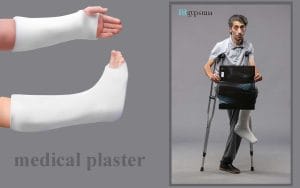 گچ شکسته بندی