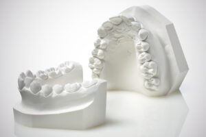 کاربرد سنگ گچ در دندانپزشکی